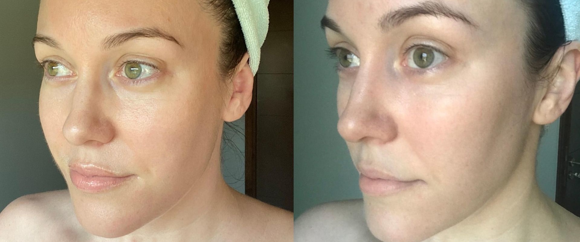 How Long Does it Take for Collagen Supplements to Work?
